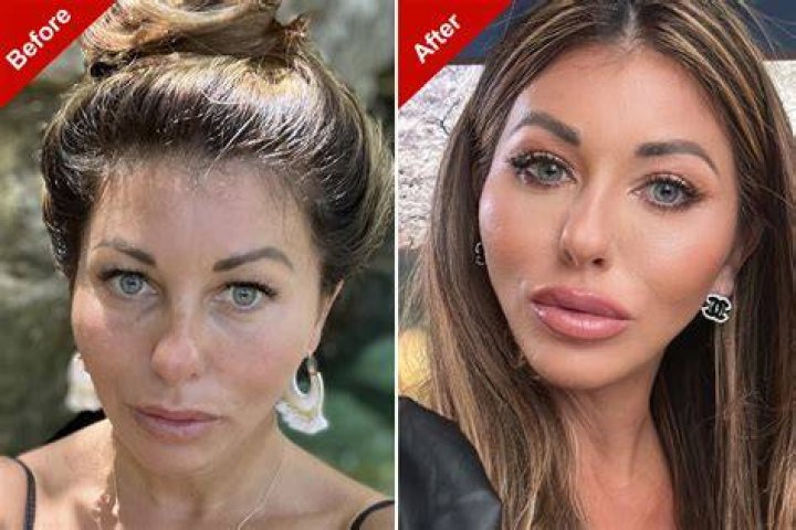 3 Surgeries At Same Time — Season 1 Episode 5 Recap – Hollywood Life