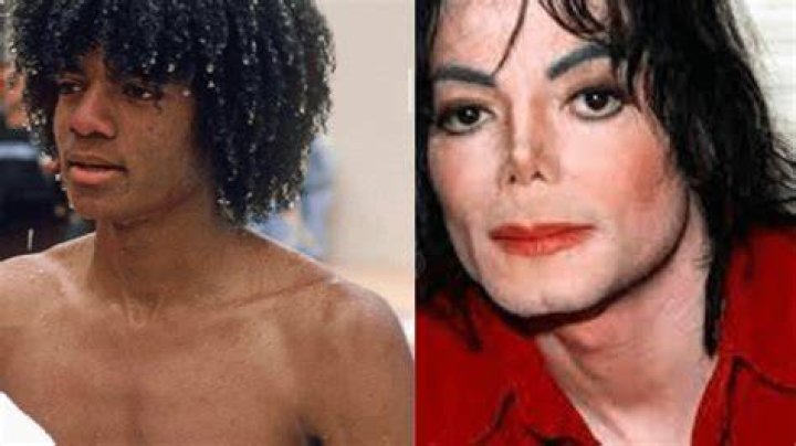 All About His Back Injury, Surgeries and More – Hollywood Life