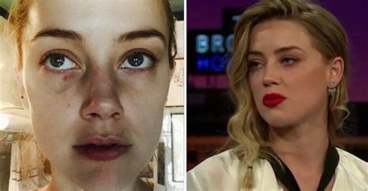 Amber Heard’s Makeup Artist Testifies That She Helped Her Cover Up Bruises
