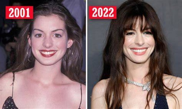 Anne Hathaway Goes Bald In The Spooky 1st Look – Hollywood Life
