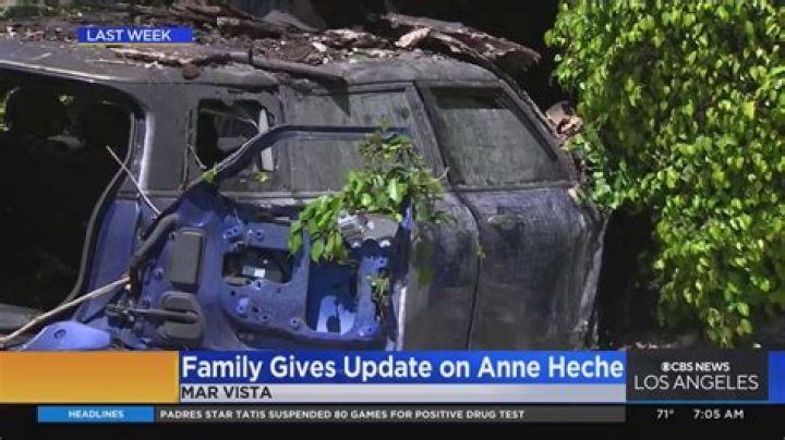 Anne Heche Declared Brain Dead & ‘Not Expected To Survive’ Following Car Crash