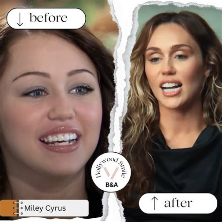 Before & After Photo – Hollywood Life