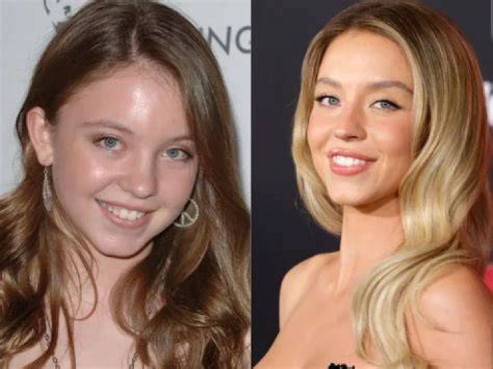 Before & After Pics — Did She Remove Implants? – Hollywood Life