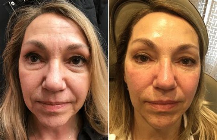 Before & After Pics Of New Auburn Locks – Hollywood Life