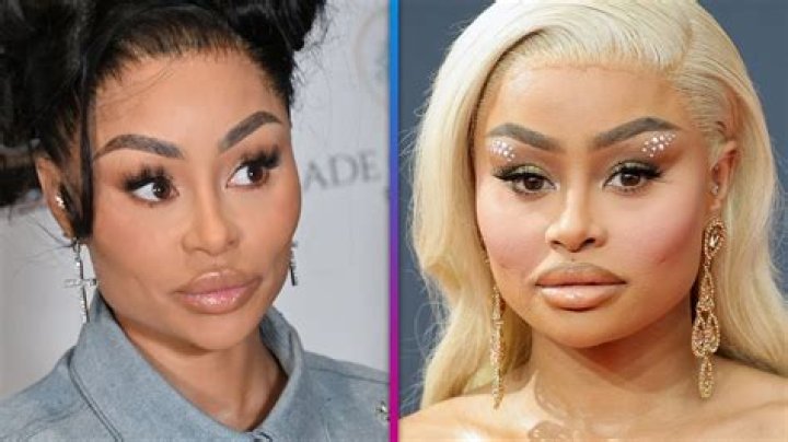 Blac Chyna Goes Makeup-Free After 2nd Round Of Dissolving Fillers – Hollywood Life
