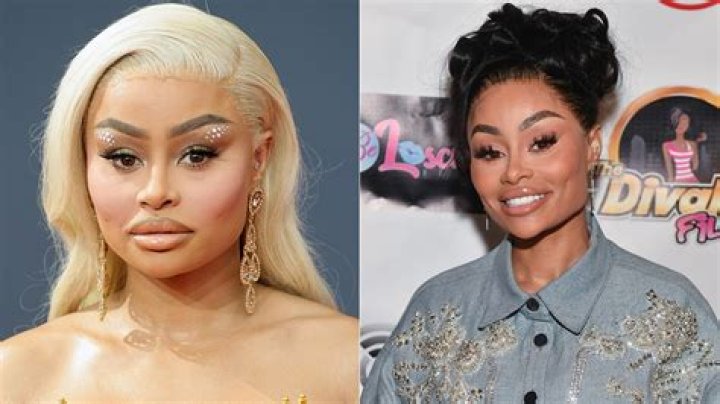 Blac Chyna Reacts To Her Face Before & After Lip Filler – Hollywood Life