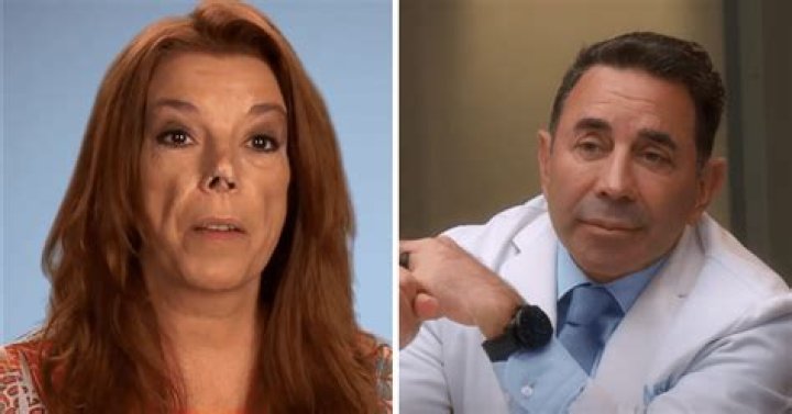 ‘Botched’ Preview: A Dog Bite Victim Comes To Dr. Nassif To Fix His Disfigured Nose — Watch