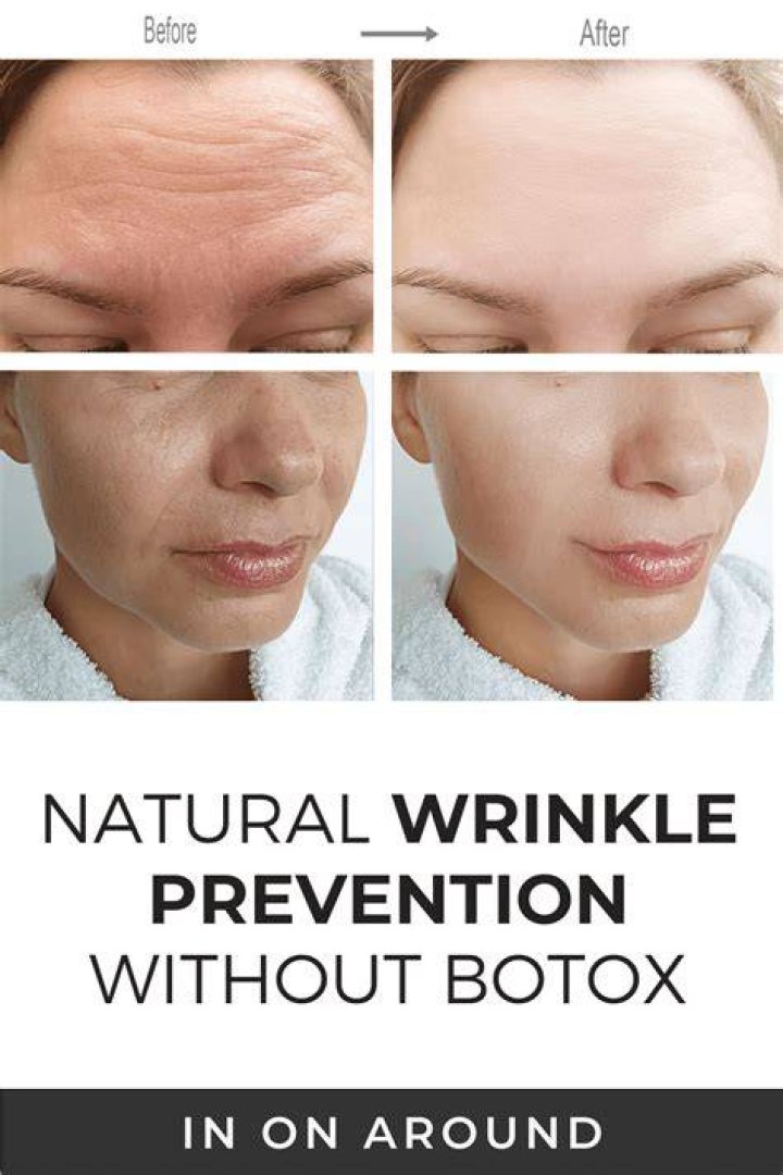 Botox Alternatives To Stop Wrinkles For Less – Shop – Hollywood Life