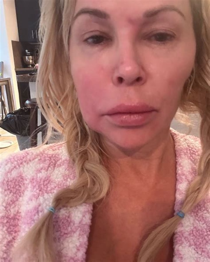 Brandi Glanville Admits To Spraying Her Kids With ‘Bleach Water’ Amid Quarantine
