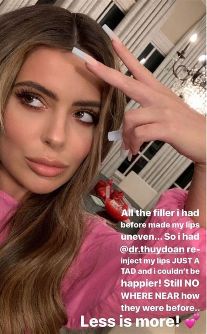 Brielle Biermann, 22, Reveals She’s ‘Dissolving’ Dramatic Lip Fillers & Is Going To Look ’18’ Again