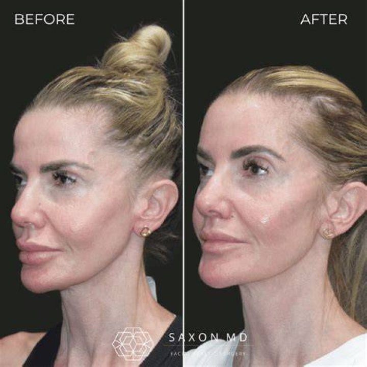 Britney, You Were So Close! Her Big Brow Oops And How YOU Can Avoid It!