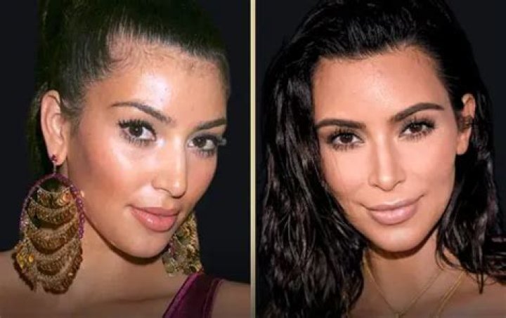 Cardi B Says Kim Kardashian Gave Her Plastic Surgery Recommendations – Hollywood Life