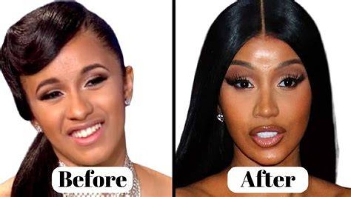 Cardi B Talks Liposuction & Plastic Surgery On IG & Shows Off Abs: Pic – Hollywood Life
