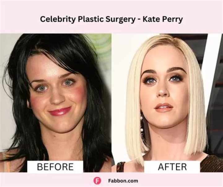 Celebrities Before & After Plastic Surgery — Photos