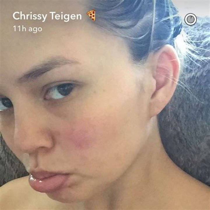 Chrissy Teigen Shares Makeup-Free Selfie While Saying Goodbye To Her ‘Pregnancy Glow’