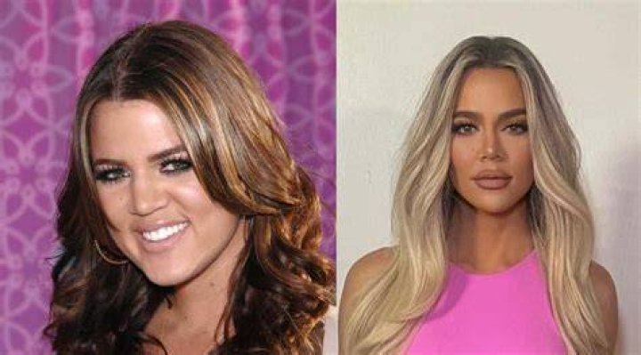 Did Khloe Kardashian Have Plastic Surgery? Doctors Say She ‘Had A Nose Job’ – Hollywood Life