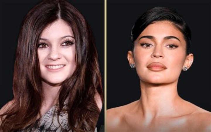 Did Kylie Jenner Get Breast Implants To Go Up 2 Sizes? Doctor Speaks – Hollywood Life