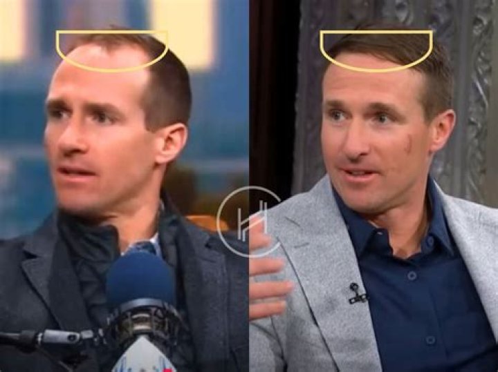 Drew Brees Has Hair At NFL Opening Day & Fans Are Confused – Hollywood Life