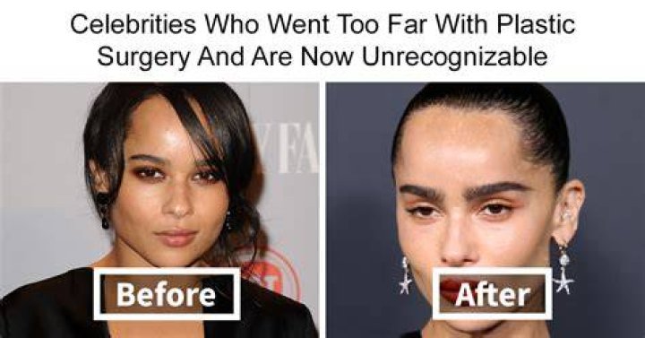 Fans Beg Her To Stop With Plastic Surgery – Hollywood Life