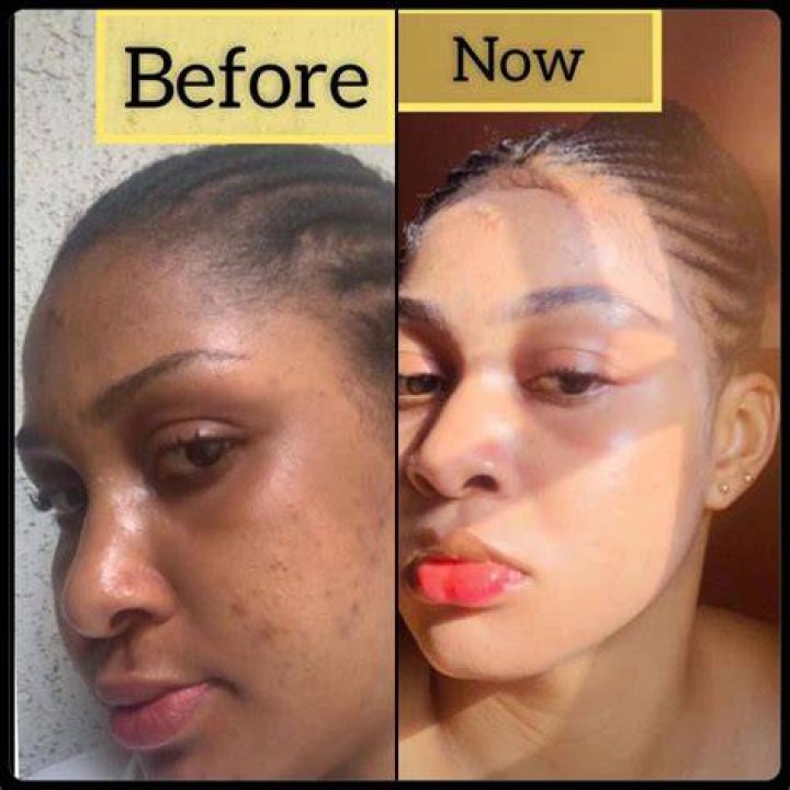 Fans Go Nuts Over Lighter Complexion – Hollywood Life