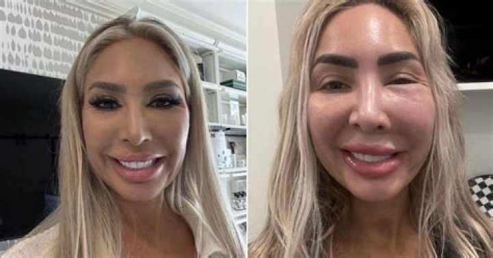 Farrah Abraham Banned From Lip Implants On ‘Botched’: Is She Destroying Her Face?