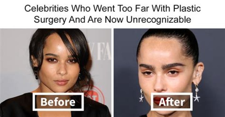 Getting 37th Plastic Surgery To Look Fake – Hollywood Life