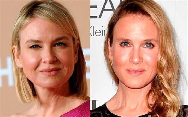 Got Plastic Surgery? – Hollywood Life