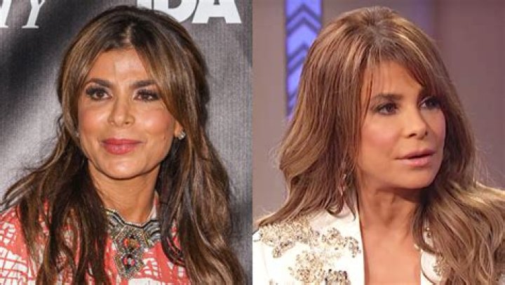 Has Sleeker Jawline Thanks To Treatment – Hollywood Life