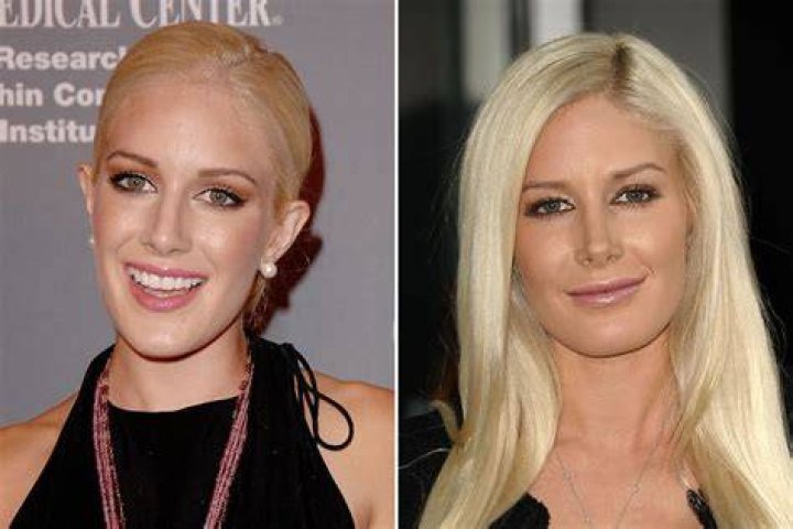 Heidi Montag Says She Almost Died After Having Plastic Surgery – Hollywood Life