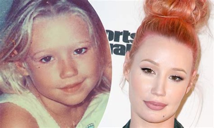 Iggy Azalea: How Her Childhood Insecurity Has Pushed Her Into Plastic Surgery
