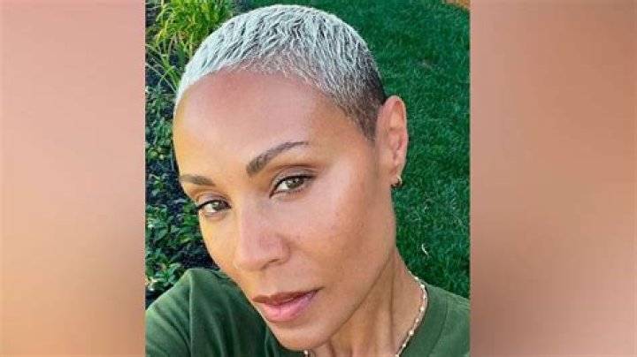 Jada Pinkett-Smith Shows Off Hair Loss Line Due To Alopecia: ‘I Can Only Laugh’ — Watch