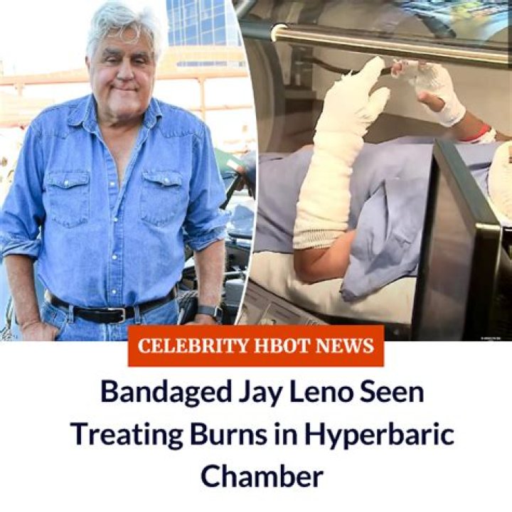 Jay Leno Seen Bandaged Up In Hyperbaric Chamber After His Car Burst Into Flames