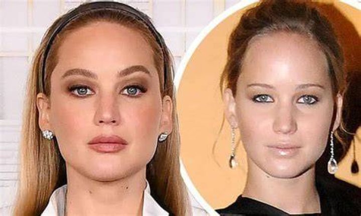 Jennifer Lawrence and Kylie Jenner Talk Plastic Surgery Rumors – Hollywood Life