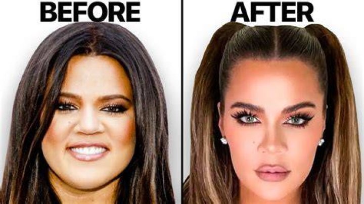 Kardashian Lip Looks Before & After – Hollywood Life