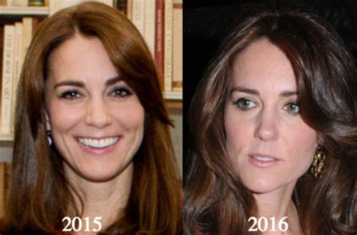 Kate Middleton Plastic Surgery Rumors Shut Down By Kensington Palace – Hollywood Life