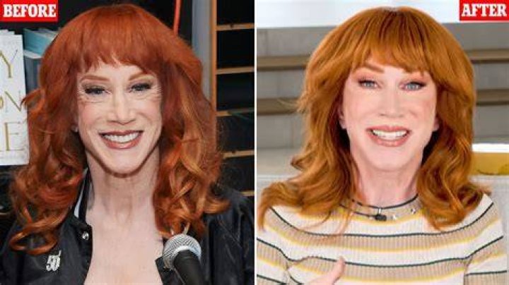 Kathy Griffin Shares Grim Photo After She’s Admitted To COVID-19 Isolation Ward: Trump’s ‘Lying’