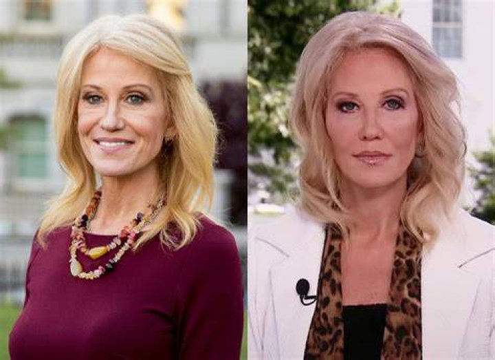 Kellyanne Conway’s Rumored Plastic Surgery Explained By Doctor – Hollywood Life