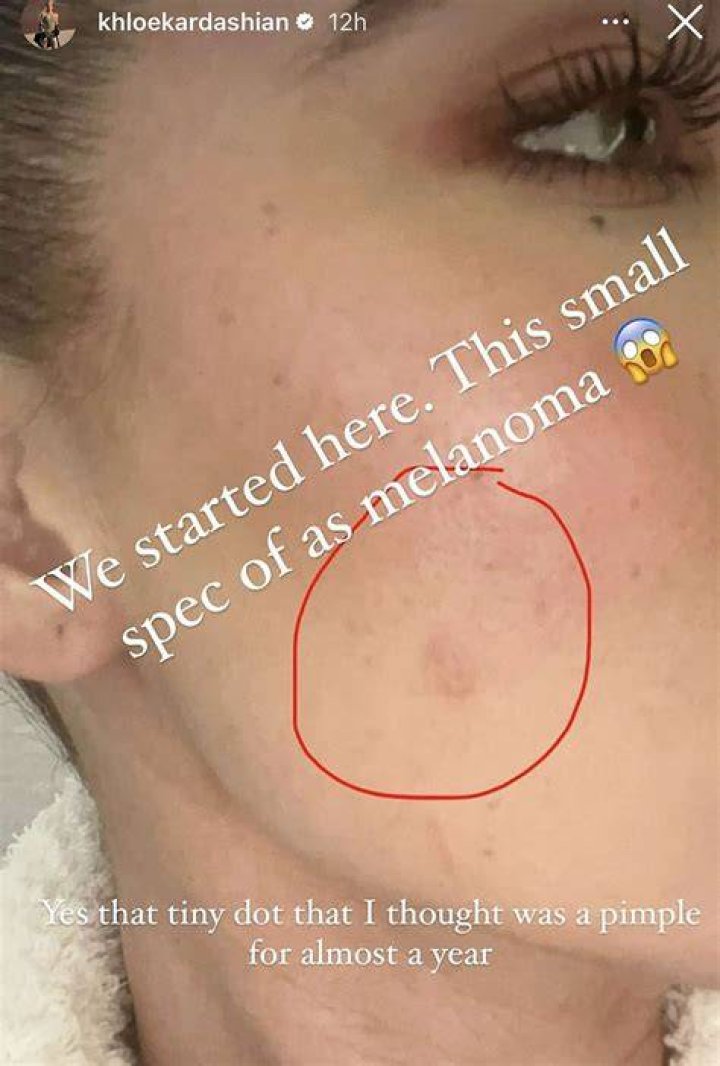 Khloe Kardashian Has This Miracle Vitamin C Serum In Her Skincare Routine – Hollywood Life