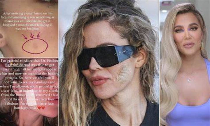Khloe Kardashian’s $12 Secret To Hide Spider Veins In Her Legs — Takes 1 Minute