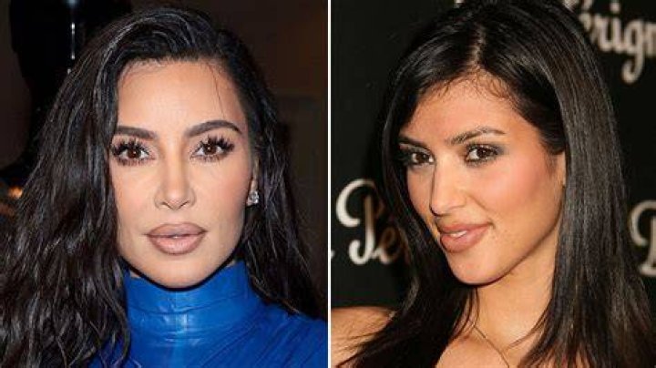 Kim Kardashian: The Terrifying Surgery She’s Avoiding By Using A Surrogate — Expert Speaks