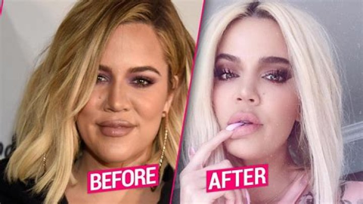 ‘KUWTK’: Khloe, 35, Reveals She’s Freezing Her Eggs As She Avoids Dating After Tristan Split