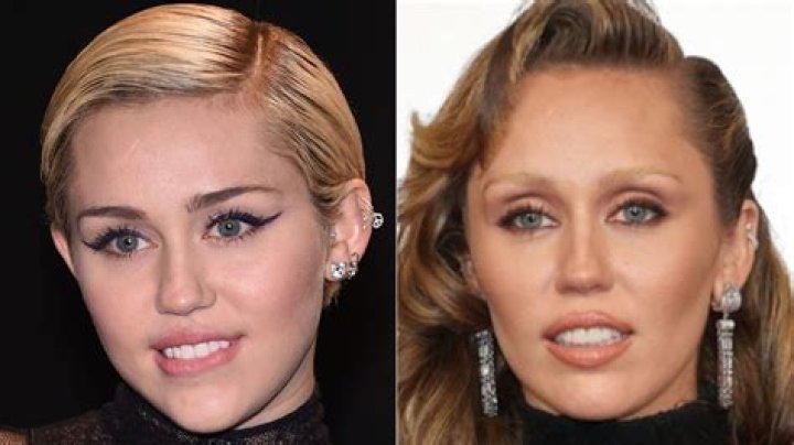 Miley Cyrus Reveals Vocal Surgery Helped Her Get Fully Sober & What Inspired Her To Keep It Up