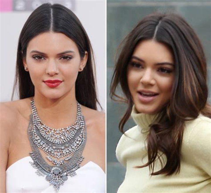 Nose Job Evidence — Did She Get Plastic Surgery? – Hollywood Life