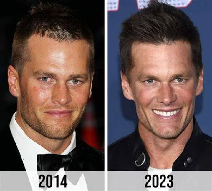 Other Celebrities Tom Brady Has Looked Like — PICS