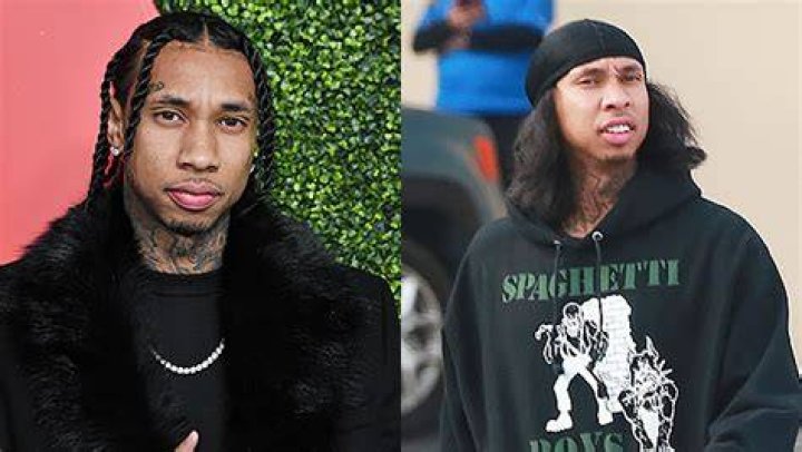 Photo Of Rapper Without Braids — Before & After Pic – Hollywood Life