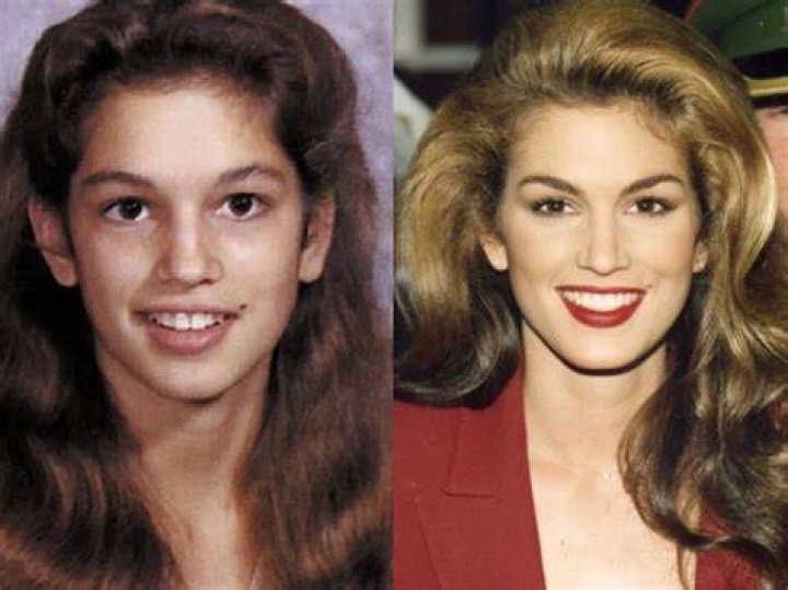 Photos Of The Model’s Transformation – Hollywood Life