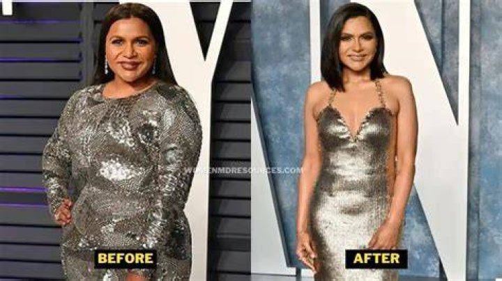 Photos Of Them Before & After – Hollywood Life