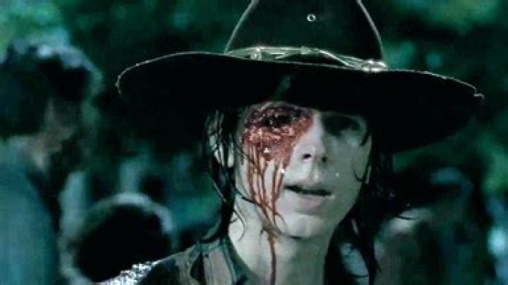[PIC] Carl’s Eye Socket On ‘The Walking Dead’ — See What’s Under His Eye Patch – Hollywood Life
