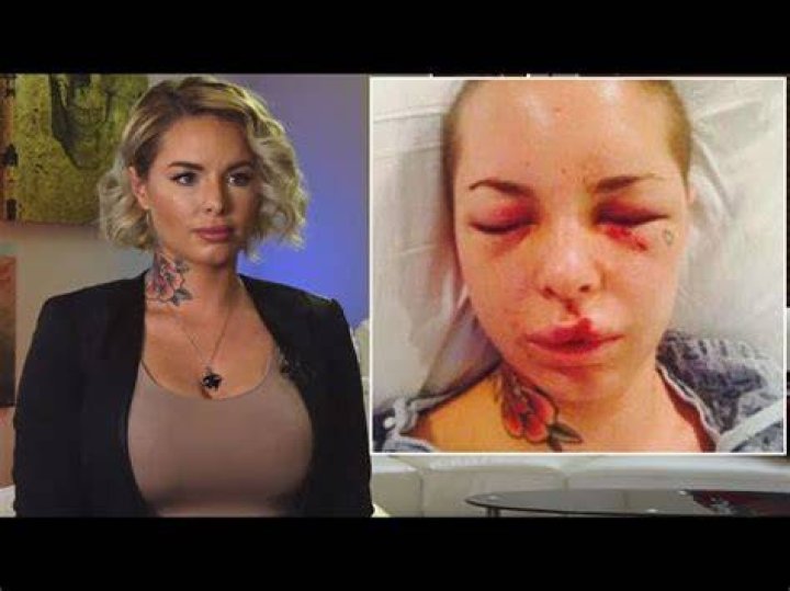 [PICS] Christy Mack’s Abuse — Graphic Statement After Alleged War Machine Fight – Hollywood Life