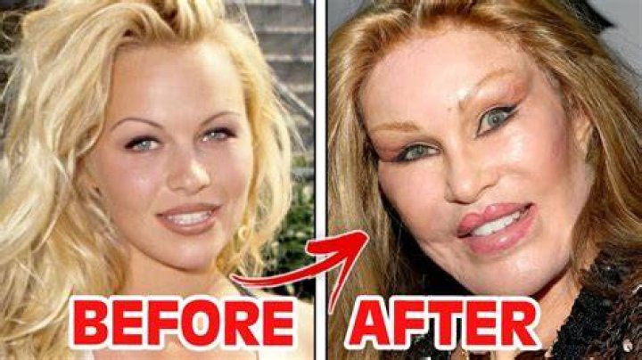 Plastic Surgery? – Hollywood Life